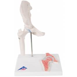 3B Scientific A84-1 Mini Hip Joint with Cross-Section Model