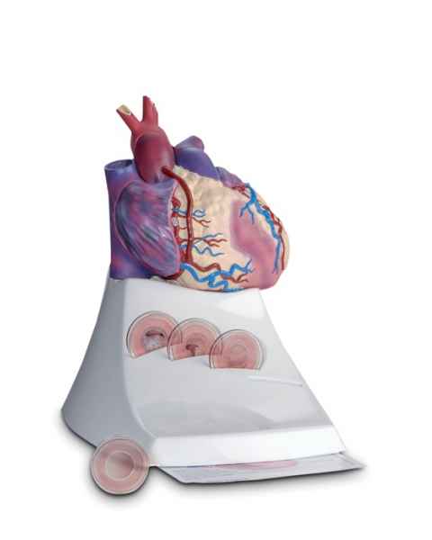 Scientific Publishing 1454M Life Size Diseased Heart Model