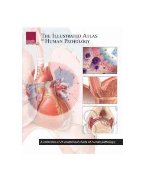 The Illustrated Atlas Of Human Pathology