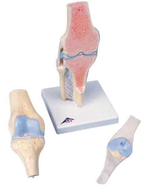 Sectional Knee Joint Model 3-Part