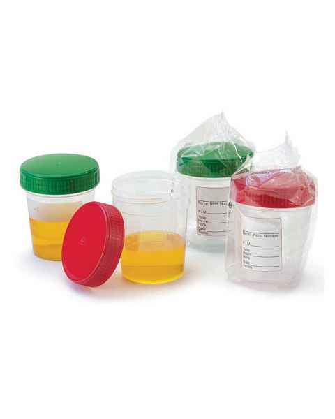 Globe Scientific Diamond® Essentials™ Specimen Container with Full Turn  Screw Cap