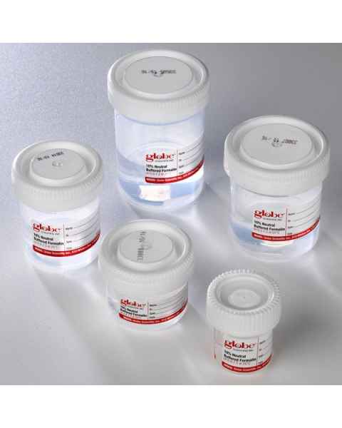 Tite-Rite Containers Pre-Filled with 10% Neutral Buffered Formalin - Attached Hazard Label