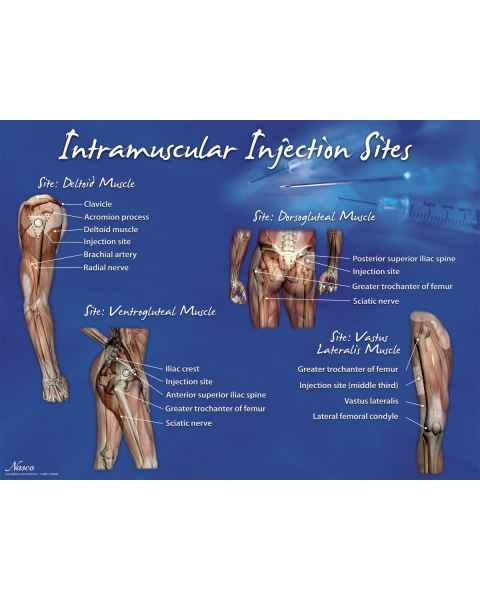 Life/form Intramuscular Injection Sites Poster