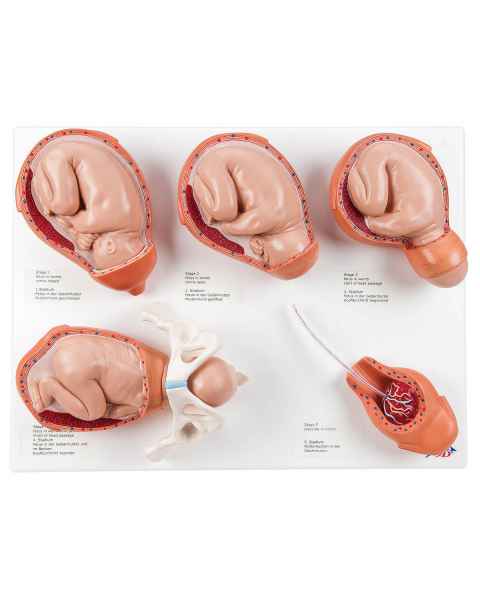 5-Stage Birth Process Model