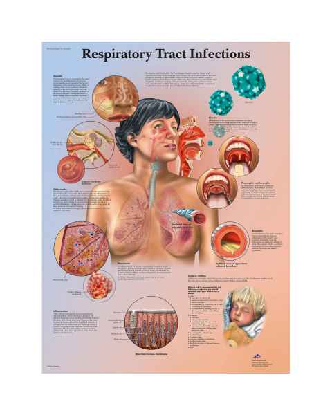 Respiratory Tract Infections Chart