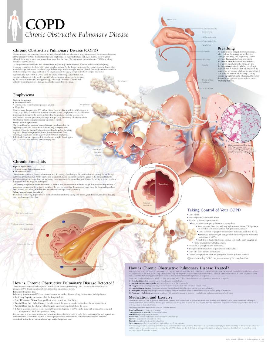 Scientific Publishing Chronic Obstructive Pulmonary Disorder Chart