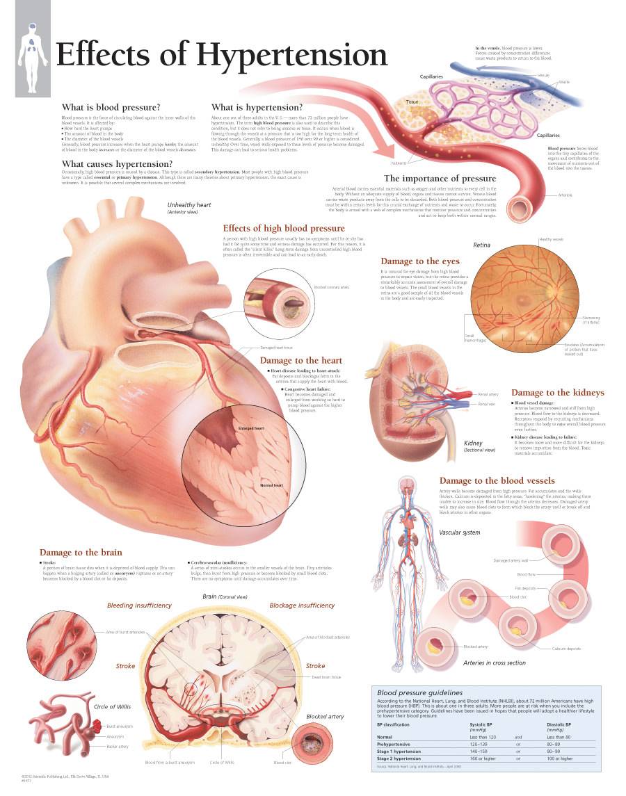 scientific-publishing-effects-of-hypertension-chart