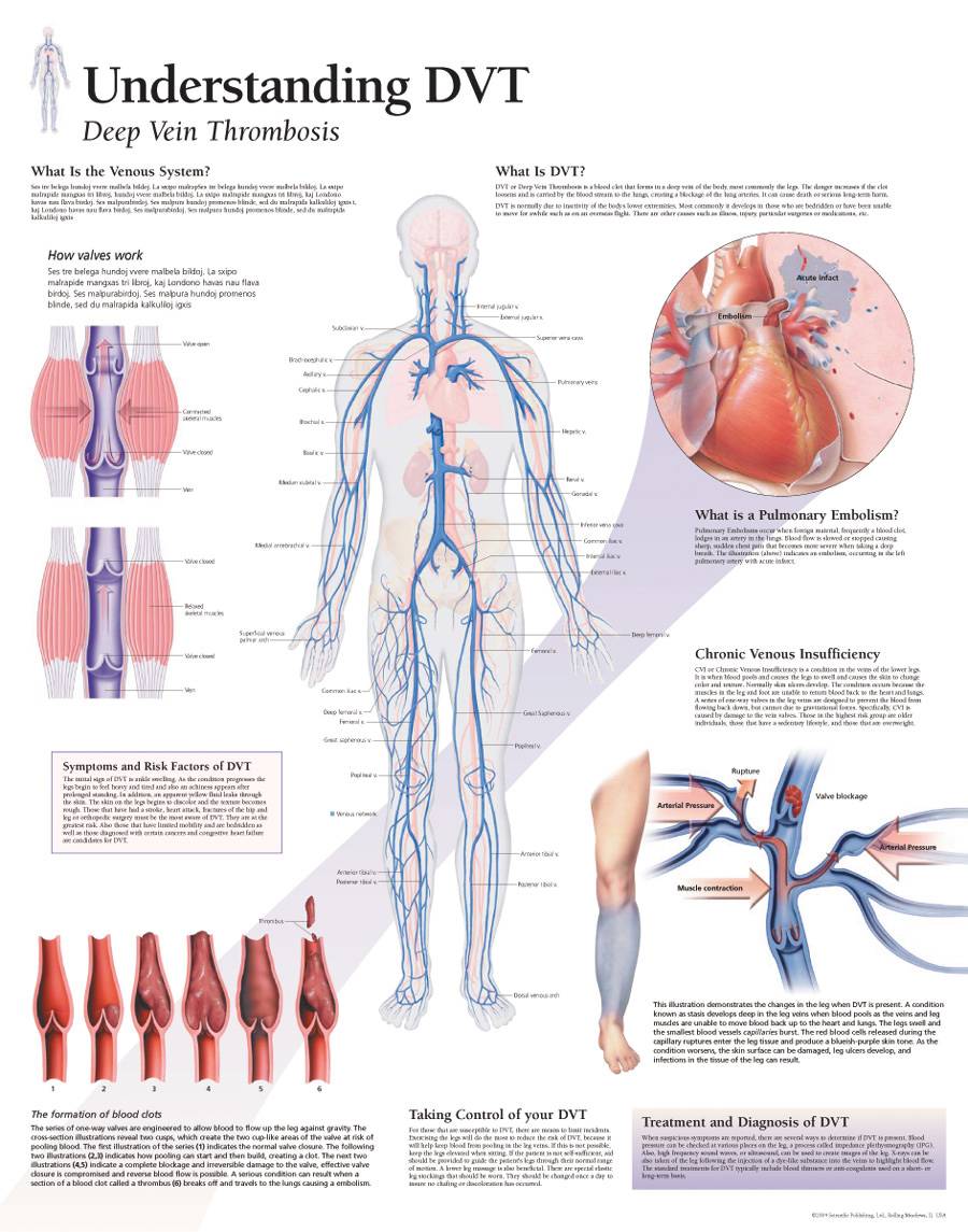 Scientific Publishing Understanding Dvt Deep Vein Thrombosis Chart