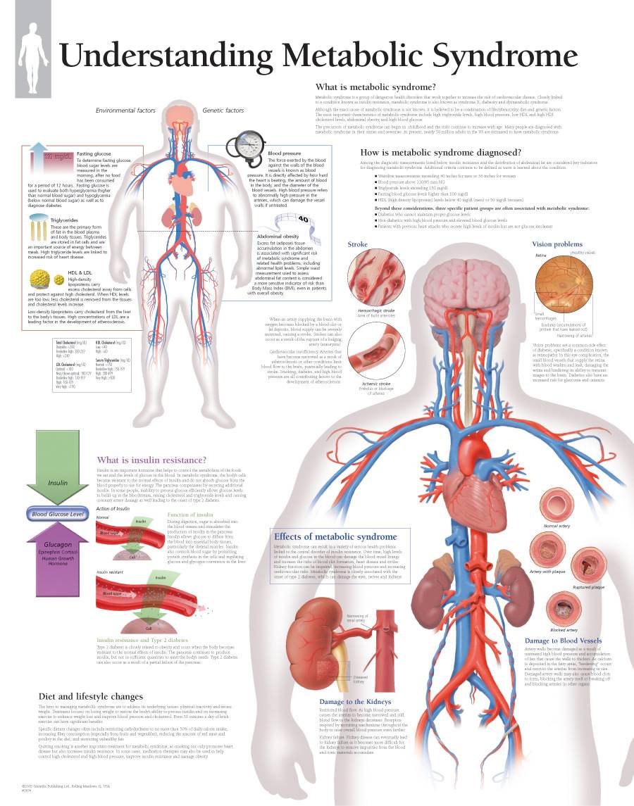 scientific-publishing-understanding-metabolic-syndrome-chart