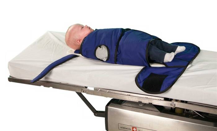 Papoose Board Radiolucent Mri Safe Papoose Board Restraint Small 8675