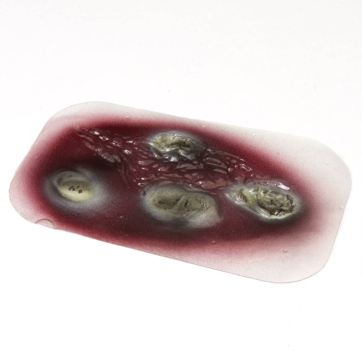 Life/form 800-914 Moulage Wound - Wound - 2nd Degree Burn ...