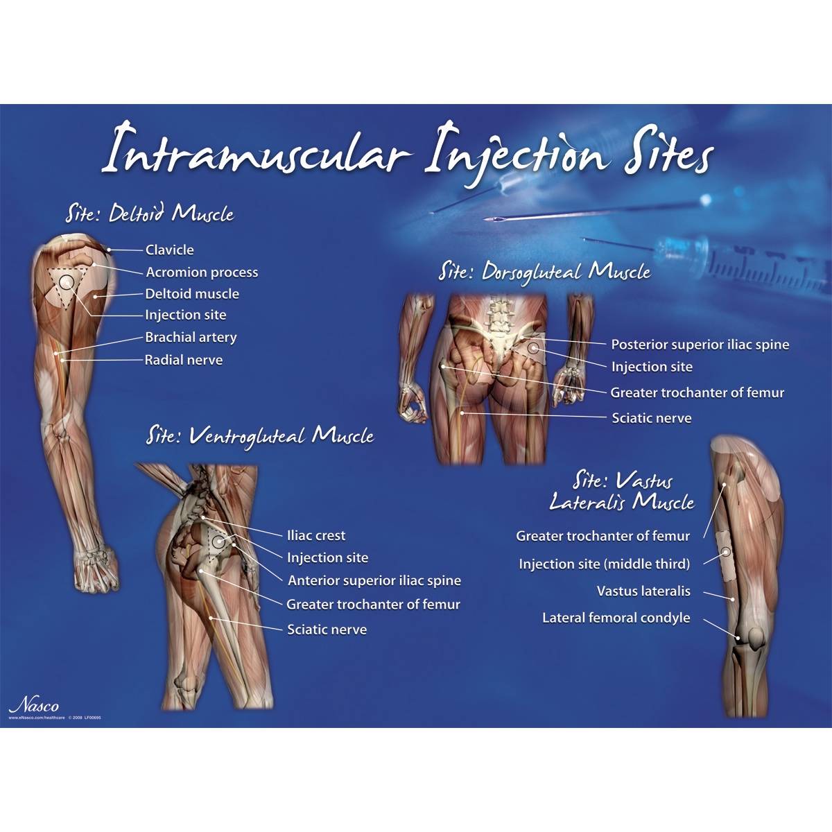 Life Form Intramuscular Injection Sites Poster