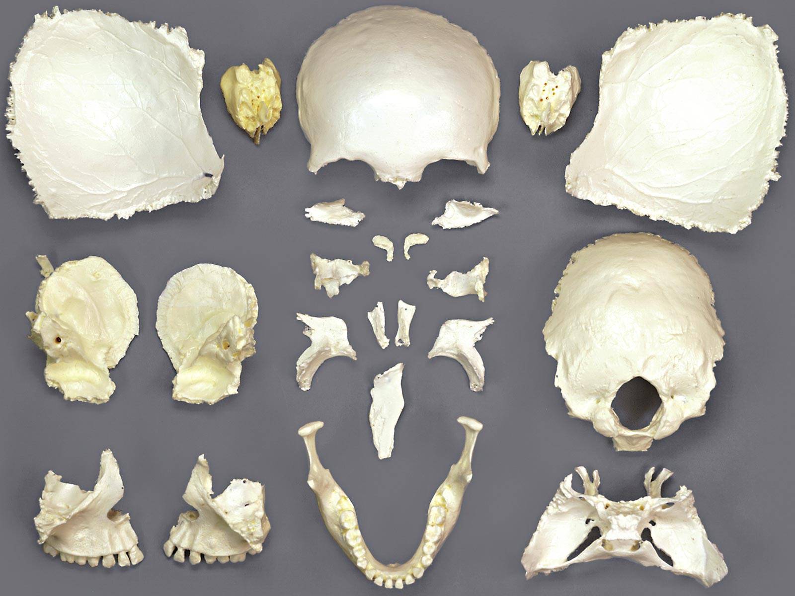 Disarticulated Female Skull Anatomical Chart Company OSM32P