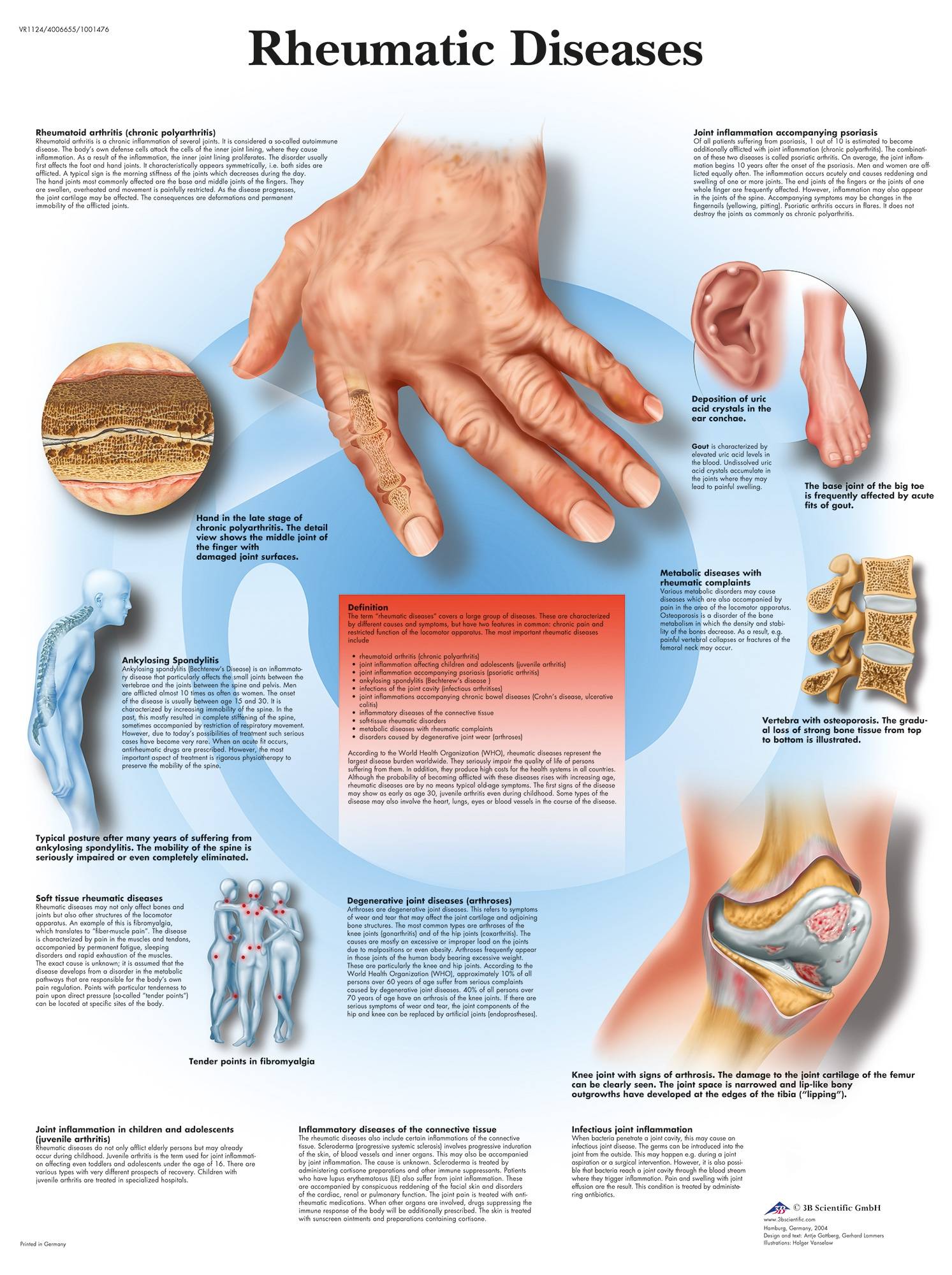 3b-scientific-rheumatic-diseases-chart