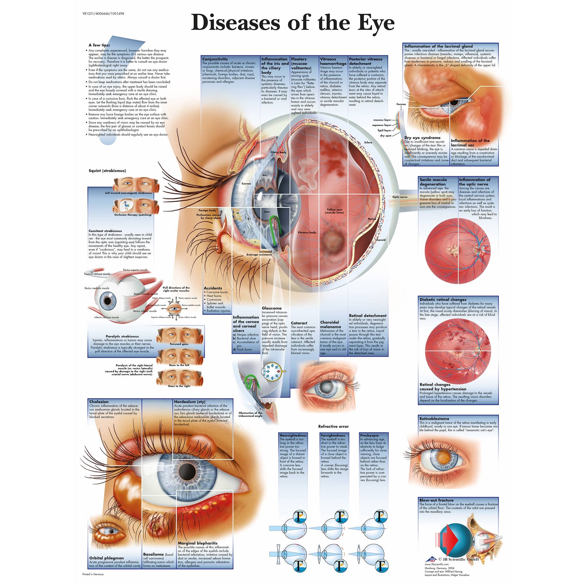 3b-scientific-diseases-of-the-eye-chart