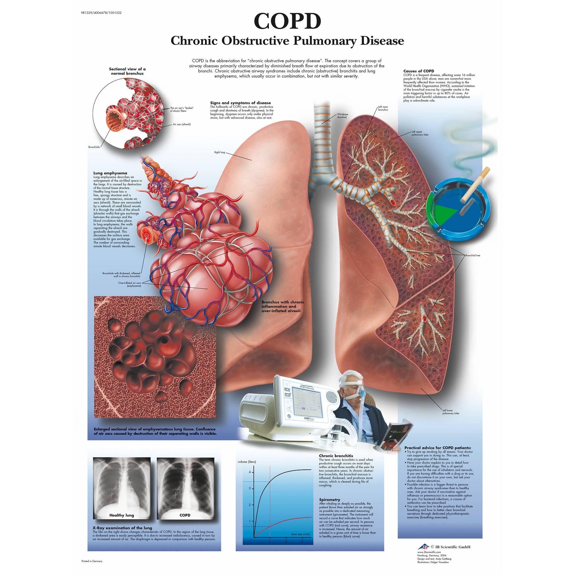 3b-scientific-copd-chart