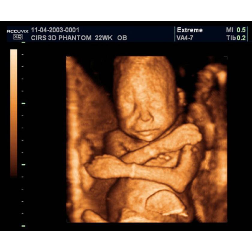 Fetal Ultrasound Training Phantom 20 Weeks CIRS 06520