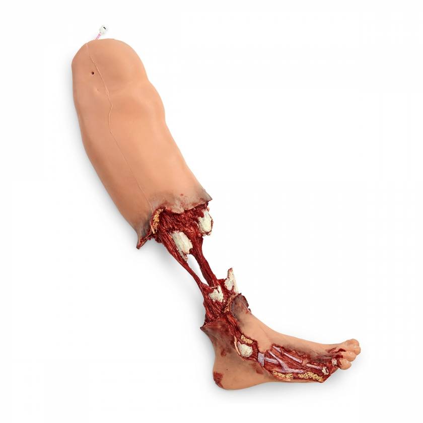 Simulaids Xtreme Trauma Bleeding Leg Moulage for STAT Simulators