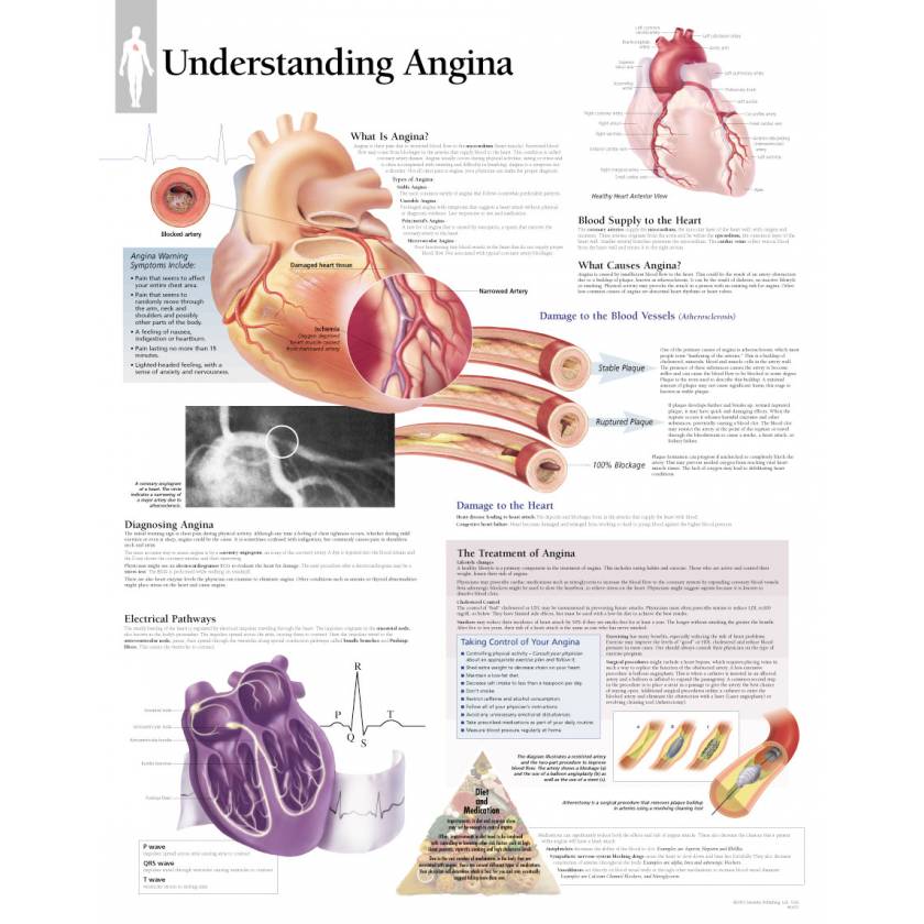Understanding Angina Chart