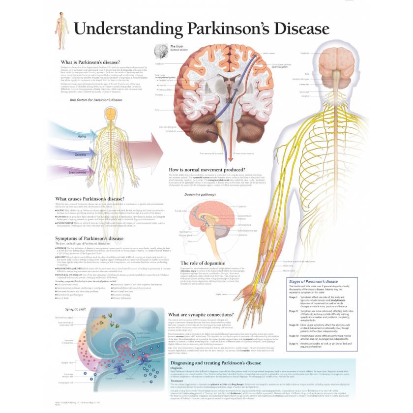 Understanding Parkinson's Disease Chart