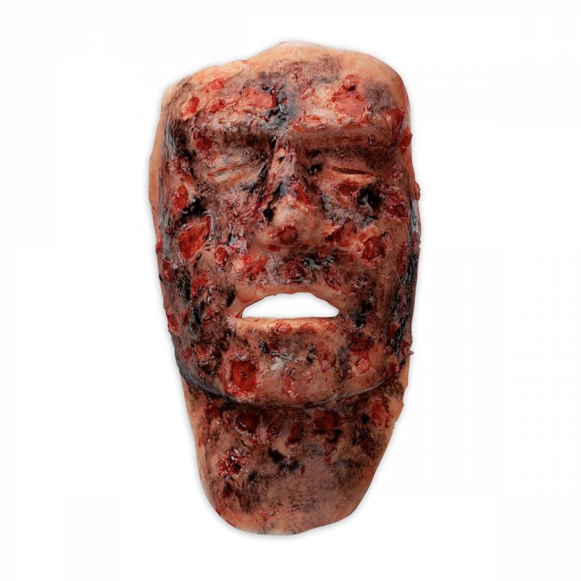 Life/form Moulage Wound - 3rd Degree Face Burn Simulator