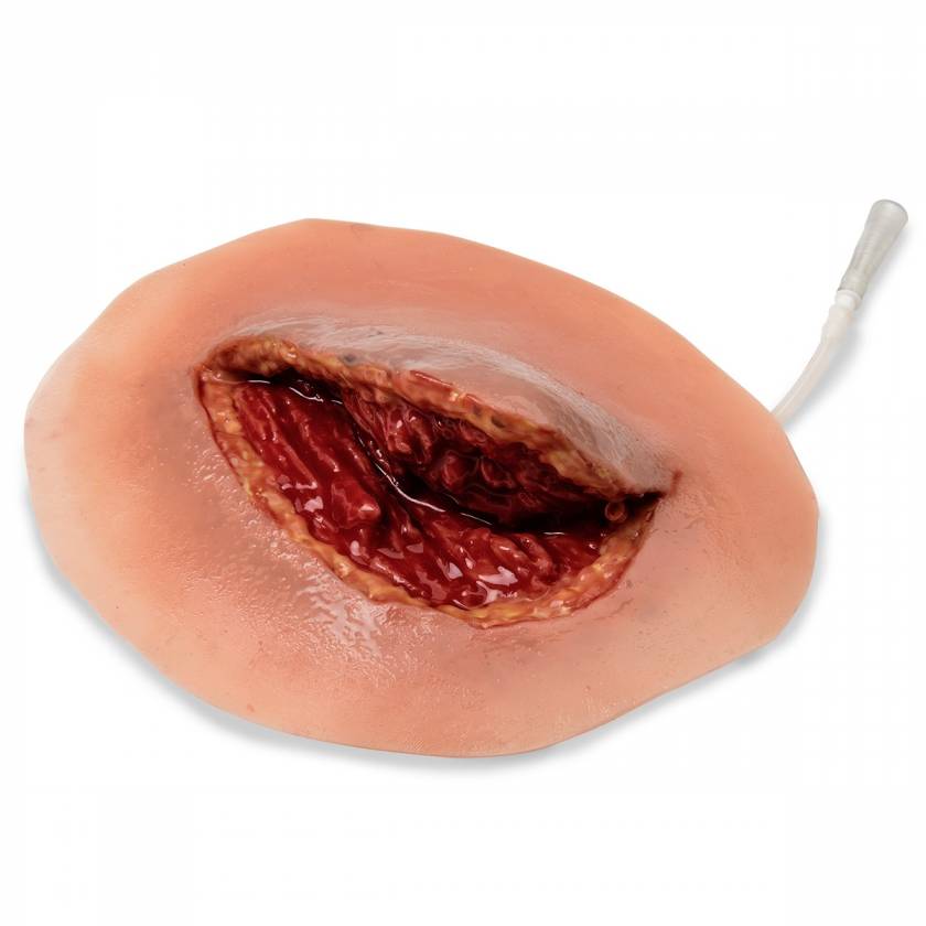 Life/form Moulage Wound - Major Muscle Laceration Simulator