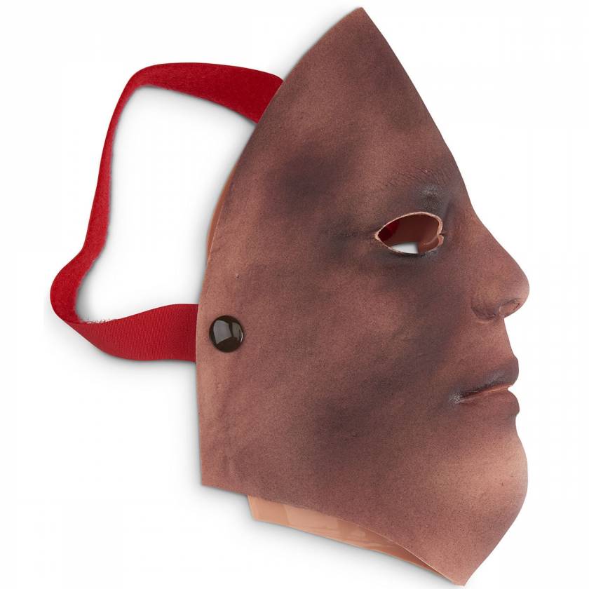 Life/form Moulage Wound - Burn - Face - 2nd/3rd Degree Simulator