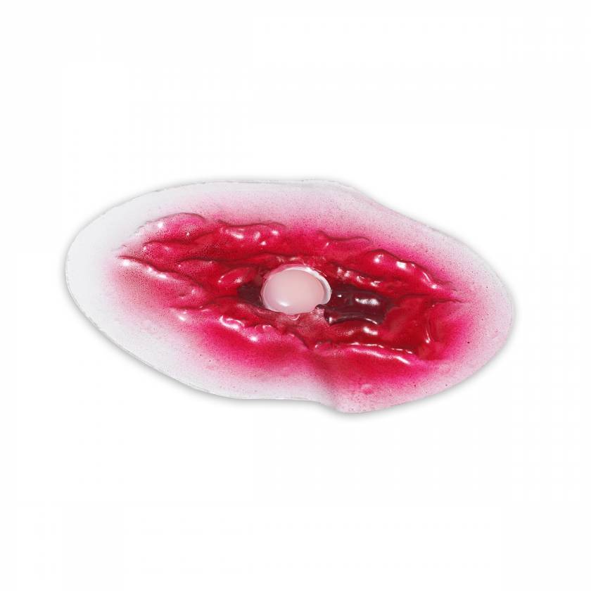 Life/form Moulage Wound - Bladder Wound Simulator