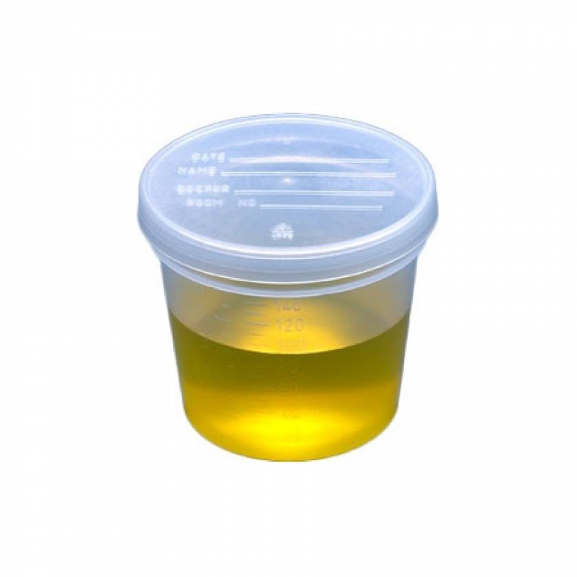 Globe Scientific Container: Tite-Rite, 120ml (4oz), PP, Sterile, Attached Natural Screw Cap, ID Label with Tab Seal, Graduated