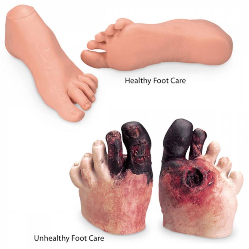 Life/form Healthy and Unhealthy Foot Care Set