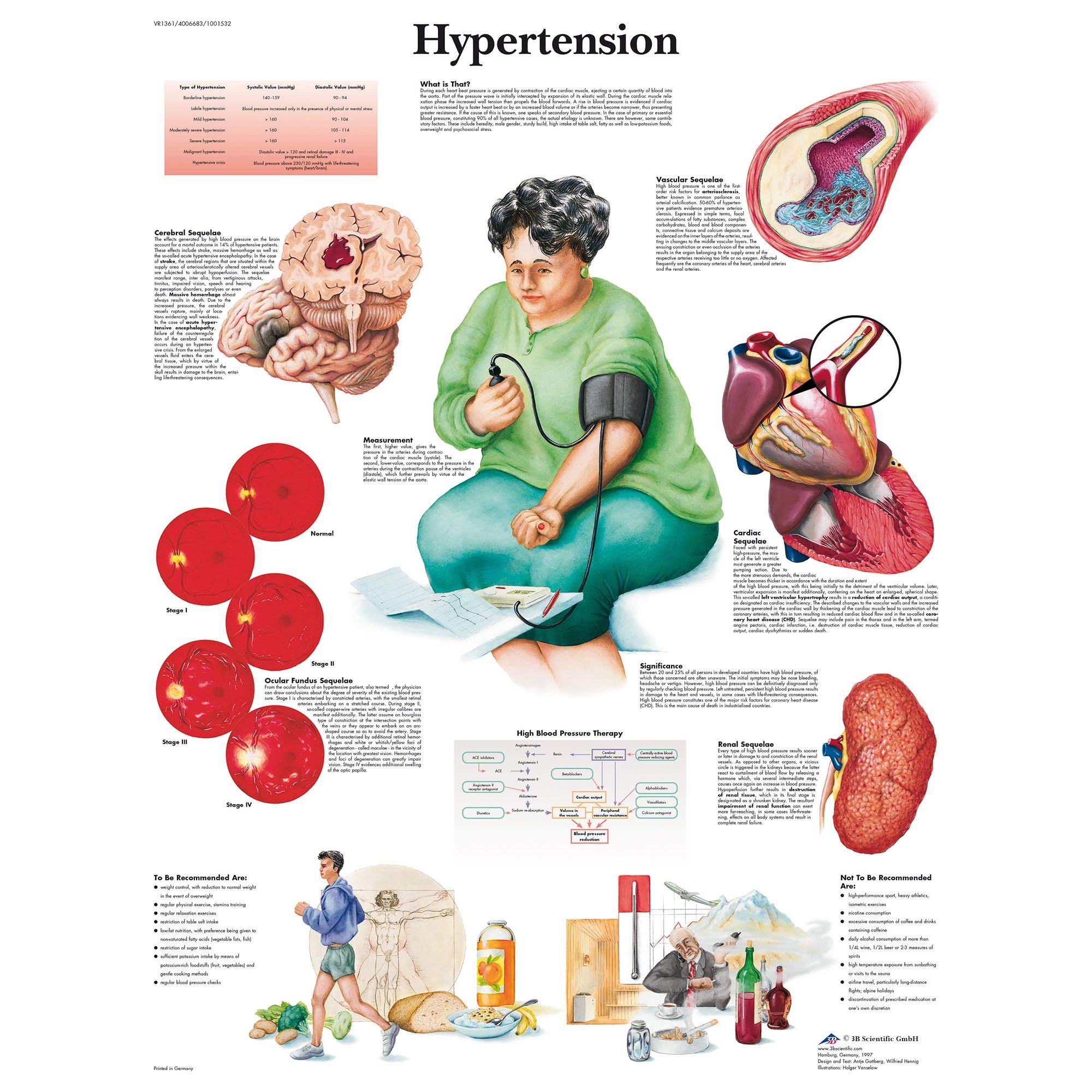 research study on hypertension