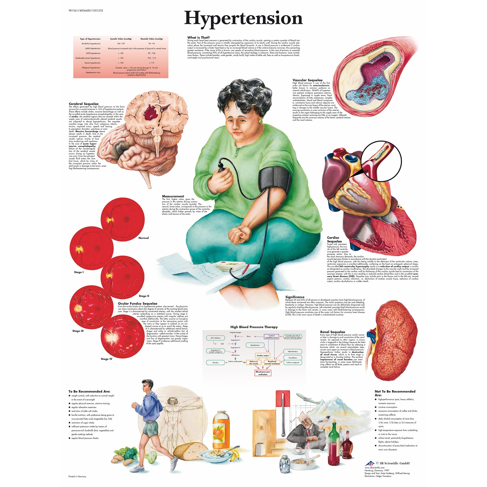 3B Scientific Hypertension Chart