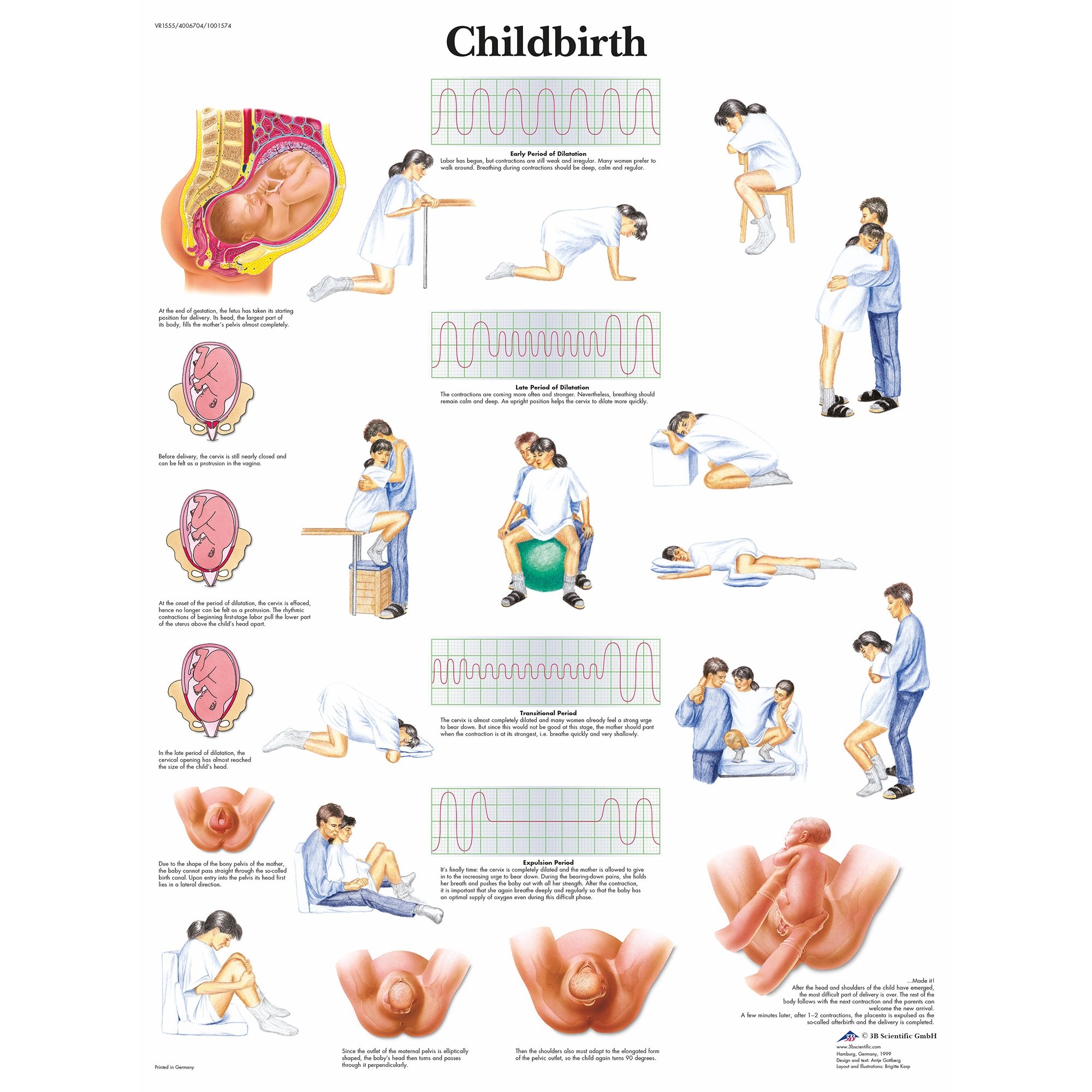 3B Scientific Childbirth Chart