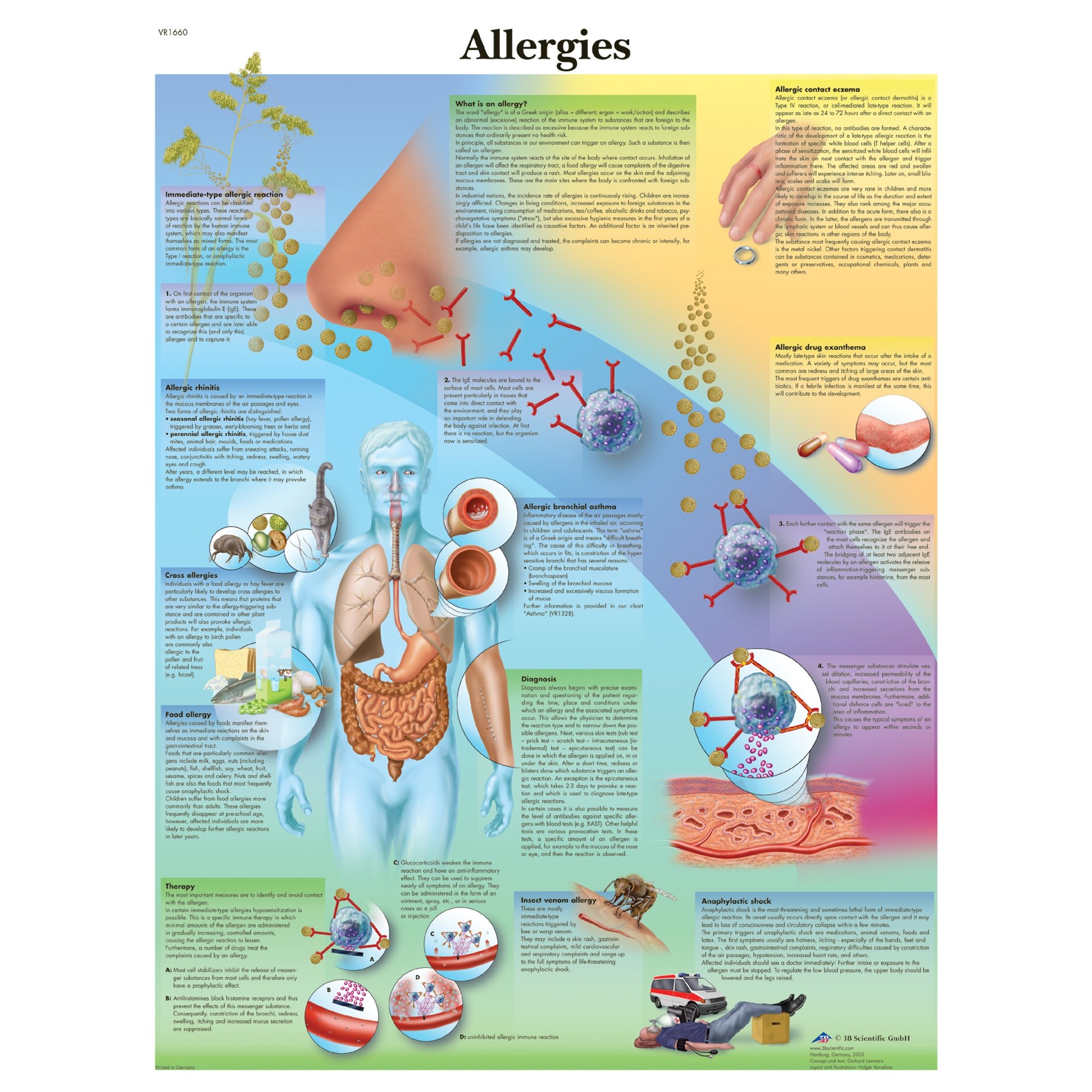 allergic rhinitis poster