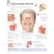 Understanding Sinusitis Chart