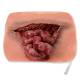 Life/form Moulage Wound - Eviscerated Intestine Simulator