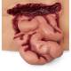 Life/form Moulage Wound - Abdominal Wound Simulator