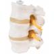 3 Lumbar Vertebrae Flexibly Mounted