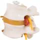 2 Lumbar Vertebrae With Prolapsed Disc Flexibly Mounted