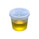 5oz Specimen Container with Snap Cap - Non-Sterile