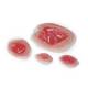 Life/form Moulage Wound - Pressure Ulcers Simulator - Set of 4