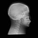 RSD Anthropomorphic Head Phantom With Complete Cervical Spine (C1-C7)