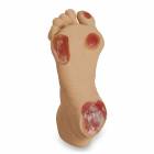 Life/form Elderly Pressure Ulcer Foot - Light